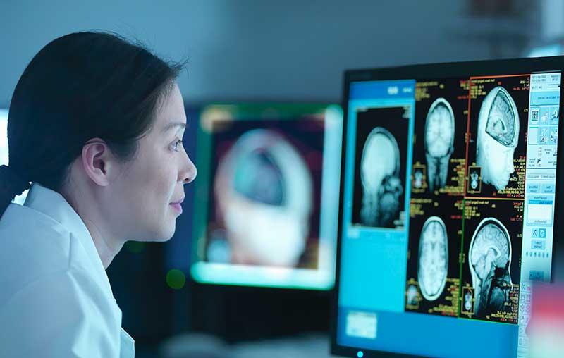 女性医学研究人员看着监视器上的脑部扫描