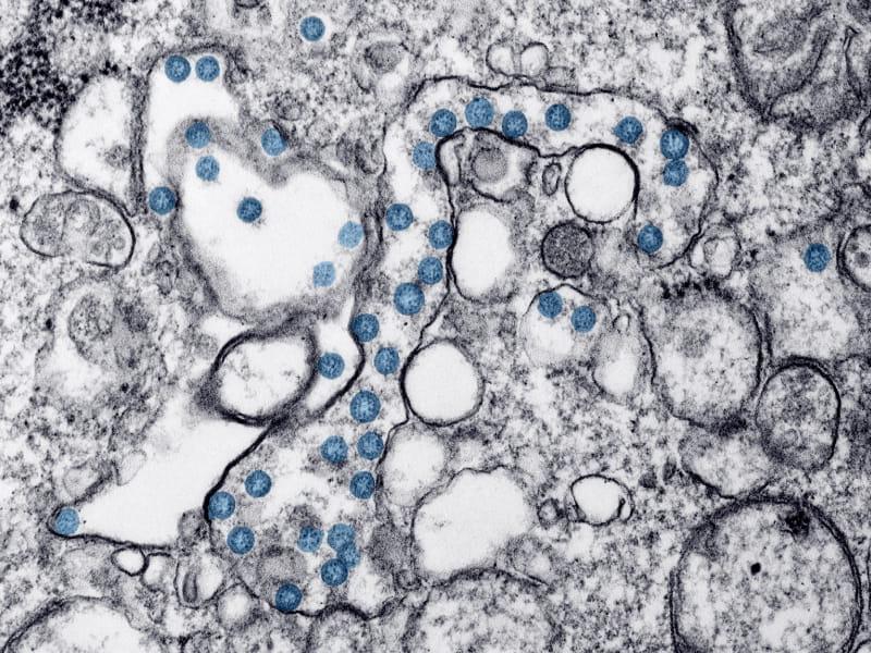 Microscopic image of COVID-19. (Hannah A. Bullock, Azaibi Tamin/CDC)